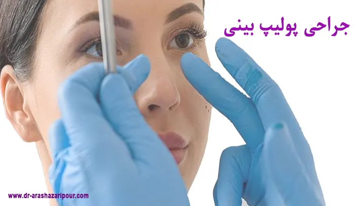 جراحی پولیپ بینی